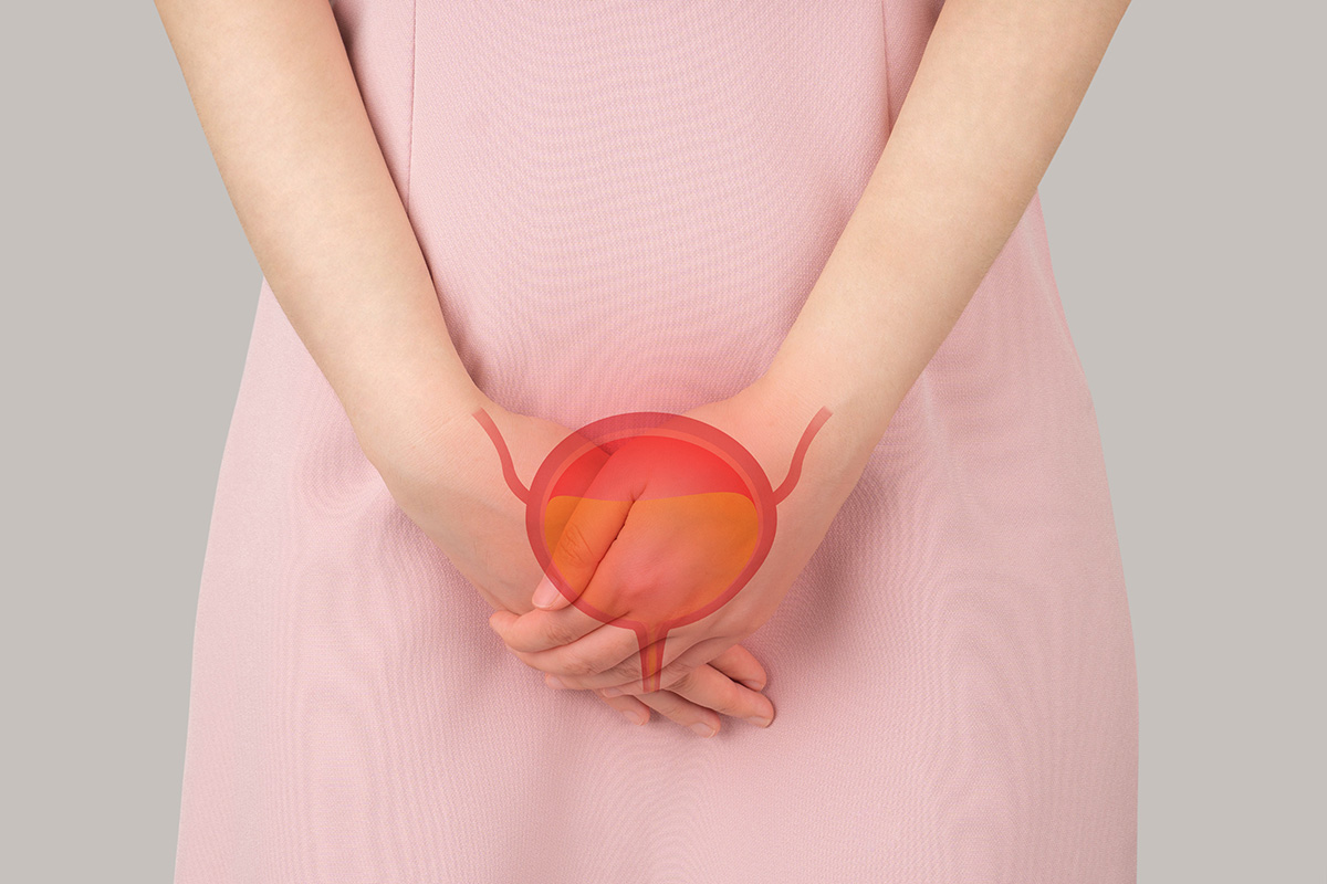 incontinence urinaire CAPP